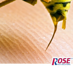 person receiving a painful sting from a wasp in columbus